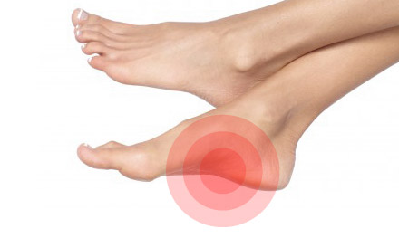 Foot Pain: Arch and Heel Pain and More